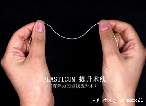 Elasticum线做埋线提升的特色和效果和其他线质有什么区别？(转载)